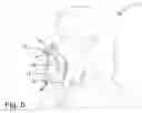 Fig. 04 - Kissing shield game and method of use thereof