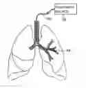 Fig. 01 - Methods of treating inflammation in airways
