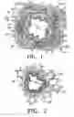 Fig. 02 - Methods of reducing mucus in airways