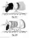 Fig. 09 - Three-dimensional finite element modeling of human ear for sound transmission