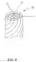 Fig. 10 - Bead structure of a tire