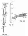 Fig. 07 - Arrangement for screening-off a space