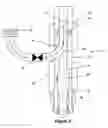 Fig. 03 - Top tensioned riser adaptor