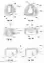Fig. 09 - Drilling apparatus with reduced exposure of cutters and methods of drilling
