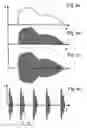 Fig. 06 - Work piece processing by pulsed electric discharges in solid-gas plasma