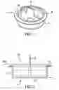 Fig. 02 - Center pull tab plug with sealing flange