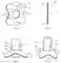 Fig. 02 - Device for holding a container