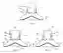 Fig. 04 - Device for holding a container