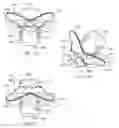 Fig. 06 - Device for holding a container