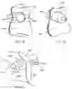 Fig. 08 - Device for holding a container