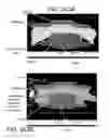 Fig. 120 - Patterned contact