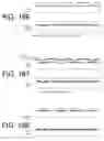 Fig. 93 - Profiled contact