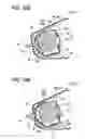 Fig. 16 - Airbag device