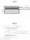 Fig. 02 - Gradient coil apparatus for magnetic resonance imaging system