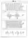 Fig. 11 - Condition-analyzing device