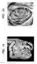 Fig. 20 - Image display method and computer readable medium for image display
