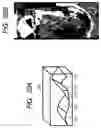 Fig. 22 - Image display method and computer readable medium for image display