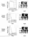 Fig. 02 - Multitask vision architecture for refractive vision corrections