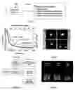 Fig. 03 - Multitask vision architecture for refractive vision corrections