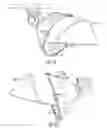 Fig. 06 - Modified reflector surface to redirect off-field side light onto field