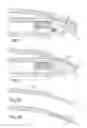 Fig. 03 - Case closed by a glass with an invisible joint or one that can be decorated and manufacturing methods