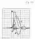Fig. 06 - Circuit arrangement for generating light pulses