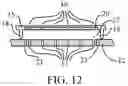 Fig. 13 - Micromachined Capacitive Microphone