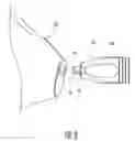 Fig. 05 - Tools for inserting a wax guard into the shell of a hearing instrument
