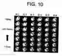 Fig. 13 - System and method for face recognition