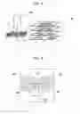 Fig. 04 - Medical image diagnosis support device and method for calculating degree of deformation from normal shapes of organ regions