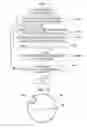 Fig. 13 - Medical image diagnosis support device and method for calculating degree of deformation from normal shapes of organ regions