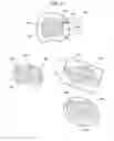 Fig. 28 - Medical image diagnosis support device and method for calculating degree of deformation from normal shapes of organ regions