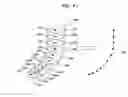 Fig. 31 - Medical image diagnosis support device and method for calculating degree of deformation from normal shapes of organ regions