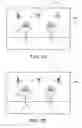 Fig. 05 - Red-eye correction method and apparatus with user-adjustable threshold