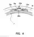 Fig. 05 - Autofocus lens apparatus and camera system with the same