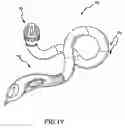 Fig. 18 - Therapeutic writing instrument devices and methods