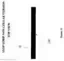 Fig. 13 - Cargo securement, cargo shift stop
