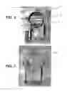 Fig. 06 - Vacuum sterilization process and devices