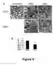 Fig. 05 - Cell-based screen for agents useful for reducing neuronal demyelination or promoting neuronal remyelination