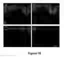 Fig. 17 - Cell-based screen for agents useful for reducing neuronal demyelination or promoting neuronal remyelination