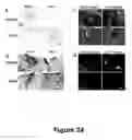 Fig. 25 - Cell-based screen for agents useful for reducing neuronal demyelination or promoting neuronal remyelination