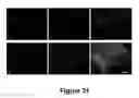 Fig. 32 - Cell-based screen for agents useful for reducing neuronal demyelination or promoting neuronal remyelination