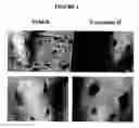 Fig. 02 - Method of measuring the biological activity of an urotensin II receptor