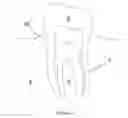 Fig. 02 - Method For Treating Periodontal Disease
