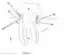 Fig. 04 - Method For Treating Periodontal Disease