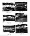 Fig. 02 - Soft tissue and bone augmentation and bulking utilizing muscle-derived progenitor cells, compositions and treatments thereof