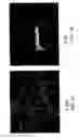 Fig. 03 - Soft tissue and bone augmentation and bulking utilizing muscle-derived progenitor cells, compositions and treatments thereof