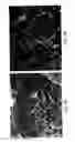 Fig. 04 - Soft tissue and bone augmentation and bulking utilizing muscle-derived progenitor cells, compositions and treatments thereof