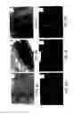 Fig. 06 - Soft tissue and bone augmentation and bulking utilizing muscle-derived progenitor cells, compositions and treatments thereof