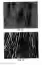 Fig. 09 - Soft tissue and bone augmentation and bulking utilizing muscle-derived progenitor cells, compositions and treatments thereof